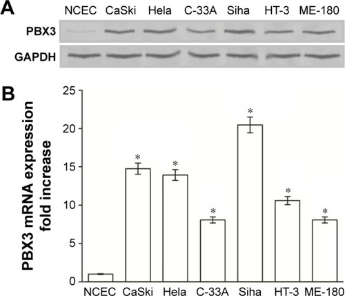 Figure 1 Overexpression of PBX3 mRNA and protein in cervical cancer cell lines.