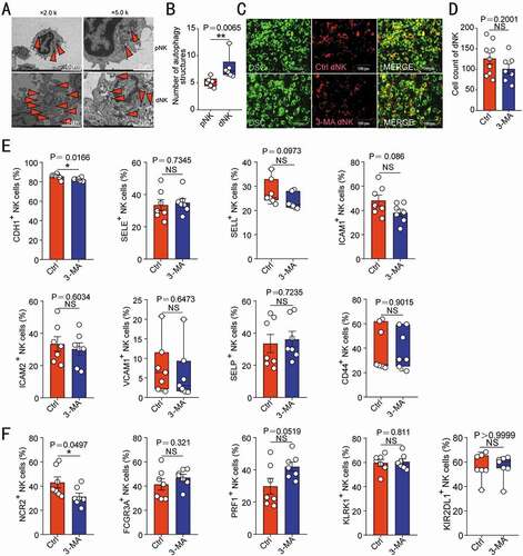 Figure 3. NK cell autophagy does not regulate its adhesion ability and cytotoxic activity-related molecules expression. (A) The autophagy structures in pNK (n = 6) and dNK cells (n = 6) were photographed using a transmission electron microscope. The number of autophagy structures was counted in (B). (C) The adhesion of dNK cells pre-treated with 3-MA (10 mM, 48 h, n = 7) or vehicle (1‰ PBS, n = 9) to DSCs was evaluated by in vitro adhesion assays. The number of adhered dNK cells was counted in (D). The expression of adhesion molecules (E) or functional molecules (F) on dNK cells treated with 3-MA (10 mM, 48 h, n = 7) or vehicle (1‰ PBS, n = 7) was analyzed by flow cytometry. Data were presented as mean ± SEM or median and quartile and analyzed by t test. *P < 0.05, *P < 0.01, NS: no significance