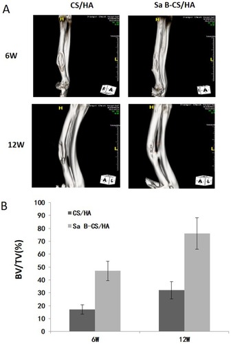 Figure 10 CT images and analysis of new bone formation.Notes: (A) After 6 weeks and 12 weeks, Group Sa B-CS/HA exhibited significant bone formation and most of the defect area was filled with whole bone cortex while the bone defect was still obvious in Group CS/HA. (B) Bone volume ratio (BV/TV) was significantly higher in Group Sa B-CS/HA compared with control group (p<0.05).