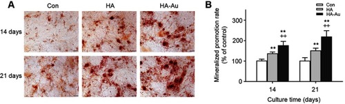 Figure 5 ARS staining (A) and calcium deposition assay (B) of hMSCs after incubation with PBS (control), HA or HA-Au in osteogenic induction medium at the concentration of 100 μg/mL for 14 and 21 days. (scale bar: 100 μm. *p<0.05, **p<0.01, comparison between control group and other groups. +p<0.05, ++p<0.01, comparison between HA group and HA-Au group).Abbreviations: ARS, Alizarin Red S; hMSCs, human bone marrow-derived mesenchymal stem cells; PBS, phosphate buffer saline; HA, hydroxyapatite; HA-Au, gold nanoparticles-loaded hydroxyapatite.