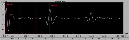 Figure 5. Typical UT waveform of the aeronautical CFRP component