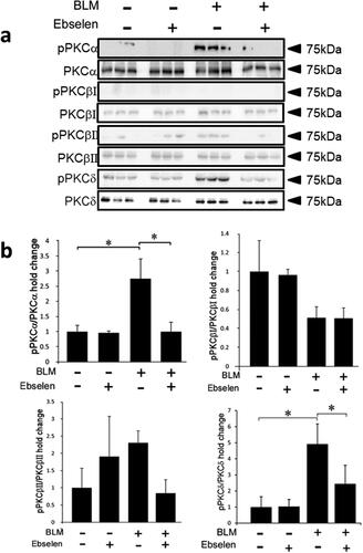 Figure 5. Effect of ebselen on the phosphorylation of PKC isoforms. (a) Western blotting was performed using a anti-phosphorylated PKC antibody to investigate the effect of ebselen on the activation of PKCα, βI, βII, and δ. (b) Measurement of band intensity. Phosphorylation of PKC isoforms induced by the administration of BLM was significantly suppressed after treatment with ebselen. P < 0.05 denotes a statistically significant difference. BLM: bleomycin; PKCα: protein kinase C-alpha; PKCβI: protein kinase C-beta1; PKCβII: protein kinase C-beta2; PKCδ: protein kinase C-delta.