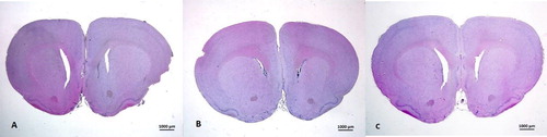 Figure 8. Coronal section of nucleus accumbens of rats in saline (a), sham (b) and US (C) groups respectively. Hematoxylin–Eosin, ×1 lens.