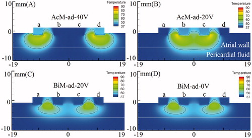 Figure 6. Temperature distribution in the atrial tissue after 60s or 120s of RF ablation across 5 mm wall thickness, considering four modes of ablation: (A) AcM-ad-40V, (B) AcM-ad-20V, (C) BiM-ad-20V and (D) BiM-ad-0V. The solid black line is the thermal damage border.