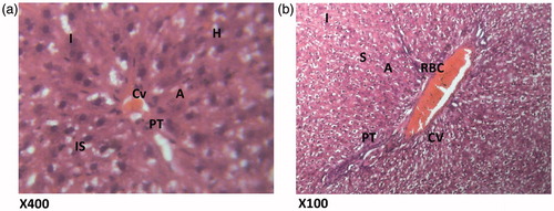 Figure 6. (HAREX 600 mg/kg + paracetamol) Histologic sections through the liver at magnification ×400 (a) and ×100 (b) show slight area of inflammation, minimal congestion of the vessels and numerous hepatocytes with good display of portal triad. Conclusion: Slightly affected. H – hepatocytes; I – inflammation; CV – cytoplasmic vacuolation; A – normal architecture; PT – portal triad; IS – interlobular septum; S – sinusoidal layer; RBC – red blood cell.