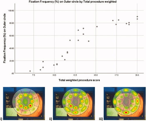 Figure 4. Graph and heat maps showing a positive correlation between total fixation frequency on the outer ring, which represented the walls of the colonic mucousa, and the total weighted procedure score (R = 0.936, p<.0001). The heat maps show the cumulative distribution of fixation frequency for (i) the lowest scoring 8 colonoscopies, (ii) the middle scoring 10 colonoscopies, and (iii) the highest scoring 8 colonoscopies (from bottom left to top right of the graph).