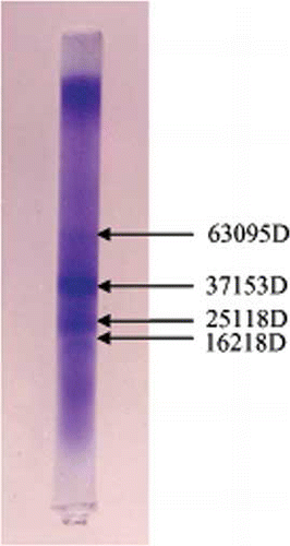 Figure 3 Photograph of M. jalapa L. seed protein (SDS-PAGE). (Color figure available online.)