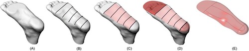 Figure 6. The workflow for creating the top surface of the insole. A 3D scan geometry is imported (A), then 5 lines are projected onto the bottom of the scanned foot (B), a loft operation is executed between the curves (C), and the toe and heel ends are completed based on the insole contour (D). the geometry is joined (E).