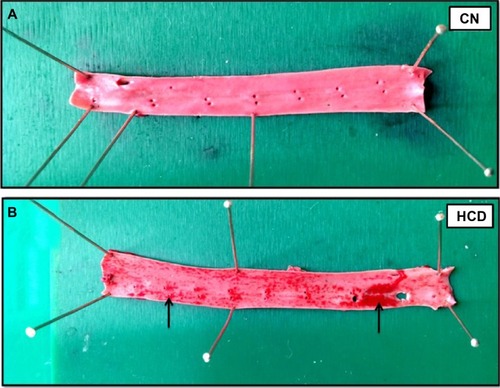 Figure 20 Photographs of thoracic aorta stained with Sudan IV dye (sudanophilia) in the CN group (A) and the HCD group (B).