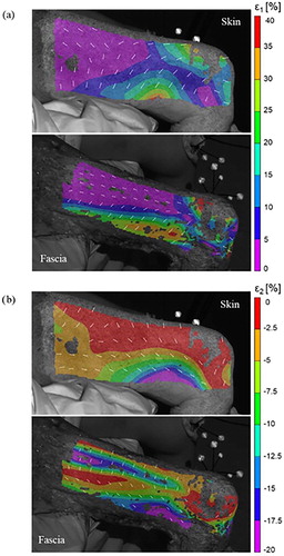 Figure 2. Principal strain fields for a hip angle of 0° and a knee angle close to 90°: (a) major ε1 strain, (b) minor ε2 strain. White arrows show the direction of the principal strains.