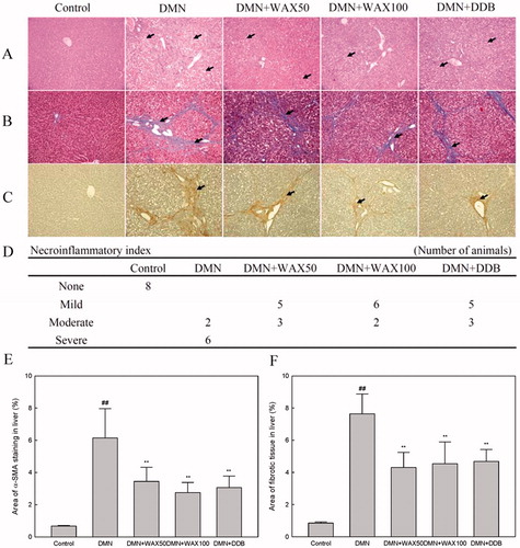 Figure 2.  Histopathological and immunohistochemical analysis. After injection of DMN (10 mg/kg), SD rats were treated with WAX (50, 100 mg/kg), DDB (25 mg/kg), or distilled water every day. Liver tissue sections fixed in Bouin’s solution were stained with H&E (A) or Masson’s trichrome (B), and subjected to immunohistochemical analysis of α-SMA (C). Histological analyses were performed at 200× magnification under an optical microscope. Solid arrows indicate necrotic hepatocyte, while the hollow arrows indicate inflammatory cell infiltration. The intensity of necroinflammation was graded as none, mild, moderate and severe (D). The percent area of the fibrotic region (E) and the α-SMA staining region (F) were analyzed by Image J software. Data were shown as mean ± SD; ##p < 0.01, compared to the normal group; **p < 0.01 compared to the DMN group (n = 8).