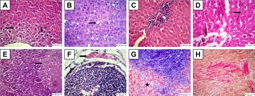 Figure 6 Histopathological changes in diabetic rats.Notes: (A) Liver shows centrilobular hepatic necrosis (arrows); (B) liver shows clear nonstaining vacuoles in hepatic cells (notched arrows); (C) liver shows focal areas of Kupffer-cell proliferation in portal area (star); (D) liver shows dilatation and congestion of central veins and in hepatic sinusoids (arrows); (E) lymph nodes show apoptotic lymphocytes (arrow); (F) lymph nodes show subcapsular vascular congestion (notched arrow); (G) spleen shows accumulation of collagen deposition in red pulp (star); H&E. (H) Collagen fibers in spleen confirmed by van Gieson stain.