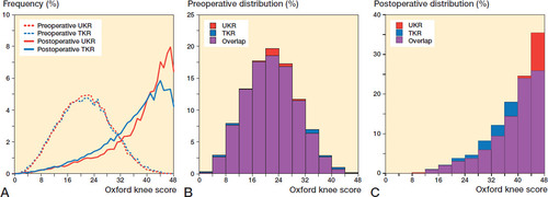 Figure 2. Distribution of OKS in TKR and UKR groups: (A) preoperative and postoperative line graph; (B) preoperative histogram; (C) postoperative histogram.