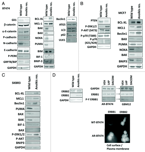 Figure 2A–D. Development of anoikis resistance in breast cancer cells. (A) BT474 cells (wild type; anoikis-resistant) were plated and 24 h later cells were isolated for immunoblotting against the indicated proteins and phospho-proteins (n = 3). (B) MCF7 cells (wild type; anoikis-resistant) were plated and 24 h later cells were isolated for immunoblotting against the indicated proteins and phospho-proteins (n = 3). (C) SKBR3 cells (wild type; anoikis-resistant) were plated and 24 h later cells were isolated for immunoblotting against the indicated proteins and phospho-proteins (n = 3). (D) BT474 cells (wild type; anoikis-resistant) were assessed for the expression of ERBB1 and ERBB2, and the impact of lapatinib (1 μM) on the phosphorylation of these proteins (n = 3); BT474 (wild type; anoikis-resistant) cells were fixed but not permeabilized and the levels of cell surface ERBB1 and ERBB2 determined.