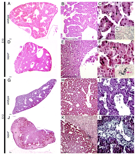 Figure 3. Abnormal liver histology in the talpid3chicken. Haematoxylin and eosin staining E10 (A–F), E12 (G, H, J, K). IHC Cytokeratin19 (C’ andF’). Masson’s trichrome staining at E12 (IandL). E10, wt livers have large spaces throughout (AandB) and exhibit an immature version of the classic hepatic triumvirate with cholangiocytes arranged in a ring to produce early bile ducts (asterisk) (C) with bile (arrow) (C) but no Cytokeratin19 present (C’). E10 talpid3 liver is more compact, with fewer, smaller, spaces (D andE). Bile ducts develop but are overcrowded with cholangiocytes (F) which express Cytokeratin19 (F’) and bile is observed between the cholangiocytes (arrow) (F). E12 wt liver is more compact (G andH). E12 talpid3 liver presents areas of necrosis (J, K) and portal fibrosis (blue stain) (L) compared with wt (I).