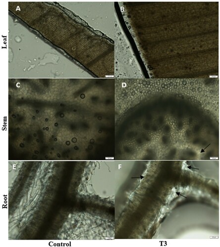 Figure 5. Microscope detection of the accumulation of MgO NP in the leaf, stem, and root of Ananas comosus var. bracteatus. Leaves, stem, and root of control plants (ACE) and var. bracteatus under 4 g/mL MgO NP for six weeks (BDF). Bar: 100 μm.