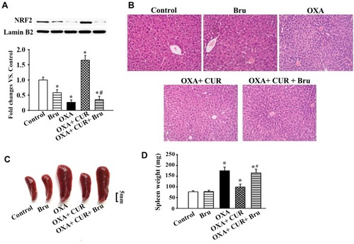 Figure 6 Effects of CUR and brusatol on the Nrf2 in the liver of mice with OXA-induced liver injury. Mice were randomly allocated into five groups: (1) Control group: administered with 5% glucose; (2) Bru group: administered with brusatol; (3) OXA group: treated with OXA on a weekly basis; (4) OXA+CUR: treated with OXA (as OXA group) plus CUR (100 mg/kg, 30 min before, and three consecutive days after, every OXA injection); (5) OXA+ CUR+ Bru: treated with OXA and CUR (as OXA+CUR group) plus brusatol (2 μmol·kg−1, 2 h before each CUR gavage). (A) The protein expression levels of Nrf2 in liver tissues of each group were measured by Western blotting. The results are presented as the mean ± standard deviation of five mice from each group. (B) Liver histopathology was examined in each group three days after the final OXA dose (H&E staining, original magnification: 100×). (C) Representative images of the spleens of each group. (D) The spleen weight of each group. The results are presented as the mean ± standard deviation of five mice from each group. *P<0.05 vs control group, #P<0.01 vs OXA+CUR group.