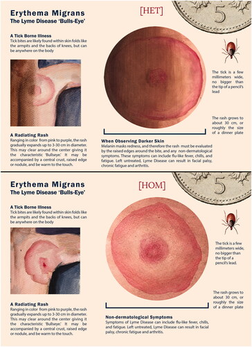 Figure 1. Erythema migrans bespoke resources for the HET and HOM variable groups.