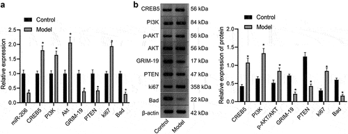 Figure 5. Expression of miR-206, Bad, GRIM-19 and PTEN is reduced, but expression of PI3K, AKT, Ki67, and CREB5 is enhanced in HCC mice. A, miR-206 expression and Bad, GRIM-19, PTEN, PI3K, AKT, Ki67, and CREB5 mRNA expression in hepatocytes of control and HCC mice, as evaluated by RT-qPCR. B, western blot analysis of Bad, GRIM-19, PTEN, PI3K, AKT, Ki67, and CREB5 protein expression in the liver tissues of control and HCC mice. * p < 0.05 vs. the control mice. n = 20 mice in each group. For this measurement data, data are shown as the mean ± standard deviation, and an independent sample t test was used for comparisons between two groups.