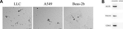 Figure 1 Identification of exosomes derived from LLC, A549, and Beas-2b cells. (A) Detection of exosomes by TEM (scale bar = 500 nm). Arrows indicate exosomes. (B) Protein expression of ALIX, TSG101, and CD63 was measured by Western blot.