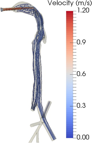 Figure 7. Flow streamlines inside the cast color-coded by air flow velocity.