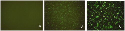 Figure 1. Cells images without or with bta-miR-145 transfection under fluorescence microscopy. (A) Bovine mammary epithelial cells without transfection (10 × 10). (B) Bovine mammary epithelial cells with bta-miR-145 mimic-FAM transfection(10 × 10). (C) Bovine mammary epithelial cells with bta-miR-145 inhibitor-FAM transfection (10 × 10).