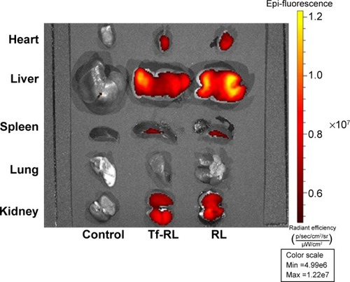 Figure 6 Tissue distribution of Cy3-anti-miR-221 liposome in normal Kunming mice.Notes: The heart, lung, spleen, kidney, and liver were harvested from female Kunming mice 4 hours after intravenous administration of Cy3-anti-miR-221-containing nontargeted liposome or transferrin-targeted liposome. Cy3 fluorescence signals were measured by IVIs imaging. Control group was treated with saline.Abbreviations: RL, nontargeted liposome containing anti-miR-221; Tf-RL, transferrin-targeted liposome containing anti-miR-221.