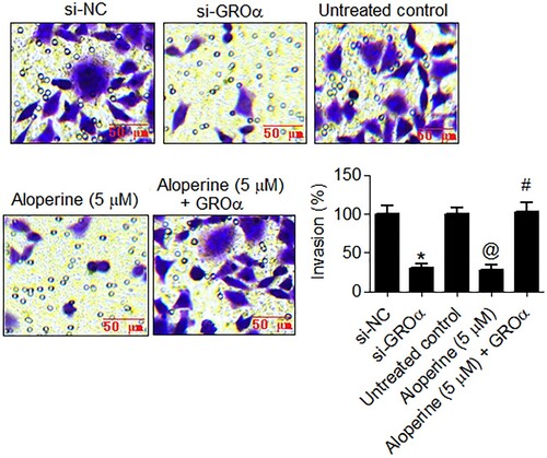 Figure 4. Aloperine targets GROα to inhibit invasion of liver cancer cells. Examination of invasion of si-GROα transfected, aloperine treated or aloperine treated GROα over-expressing SNU-182 cells by transwell chamber method with reference to corresponding negative control cells. Three replicates were used for performing the experiments and the data is presented as mean ± SD (*P < .05 for si-NC vs. si-GROα, @P for untreated control vs. Aloperine (5 µM) and #P < .05 for Aloperine (5 µM) vs. Aloperine (5 µM) + GROα).