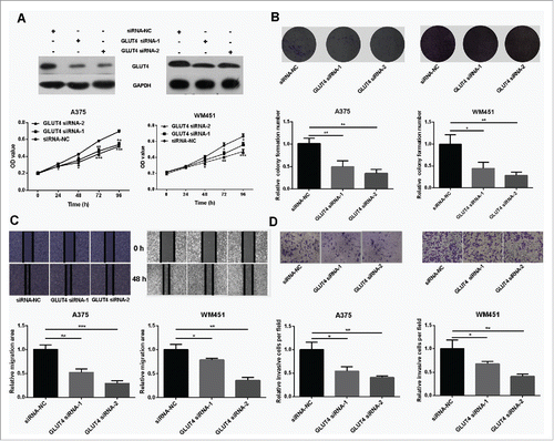 Figure 4. Knockdown of GLUT4 reduces proliferation and metastasis of melanoma cells. (A) Western Blot confirmed that GLUT4 siRNA can significantly knockdown the expression of GLUT4. (B) MTT assay showed decreased proliferative ability in GLUT4 siRNA-transfected A375 and GLUT4 siRNA-transfected WM451 cells than that in NC cells. (C-D) Scratch and Transwell invasion experiments showed inhibited migration and invasion ability in A375 and WM451 cells after down regulation of GLUT4. ***P < 0.001, **P < 0.01, *P < 0.05.