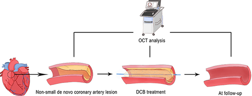 Figure 3 Optical coherence tomography analysis of the drug-coated balloon for de-novo coronary lesions exceeding 2.5 mm in diameter.