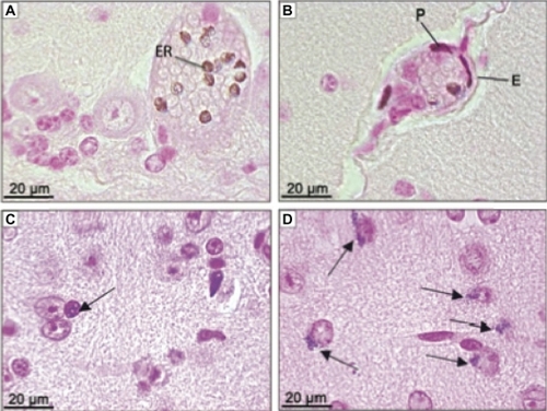 Figure 4 Photomicrographies of CNS showing ferric pigment in animals treated with MAN. (A) Erythrocytes in capillary from cerebellum 12 hours after treatment; (B) cells from BBB 12 hours after treatment; (C) glial cell (arrow) next to neurons from brain 24 hours after MAN treatment; (D) neurons from brain with nanoparticle clusters in one of the polar regions (arrow) 30 days after treatment. (A and B) sections stained with hematoxylin and eosin; (C and D) sections stained by Perls’ method.Abbreviations: ER, erythrocyte; P, pericyte; E, endothelial cell; MAN, magnetic albumin nanosphere; BBB, blood–brain barrier; CNS, central nervous system.