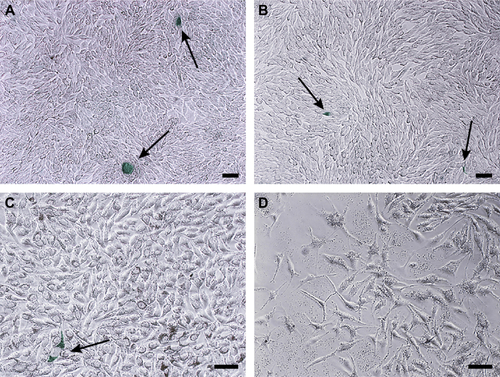 Figure S2 Senescence investigation.Notes: Microscopic images of B16F10 cells after treatment, for 72 hours, with PBS (A), DMSO (B), ND (200 μg/mL) (C), ND + C (200 μg/mL) (D), C (640 μM) (E), and DOX (F). In green were evidenced, by a specific kit, the senescent cells. The arrows indicate single cells showing the senescent phenotype. The black bars indicate 45 μm.Abbreviations: PBS, phosphate-buffered saline; DMSO, dimethyl sulfoxide; ND, nanodiamond; C, citropten; DOX, doxorubicin.