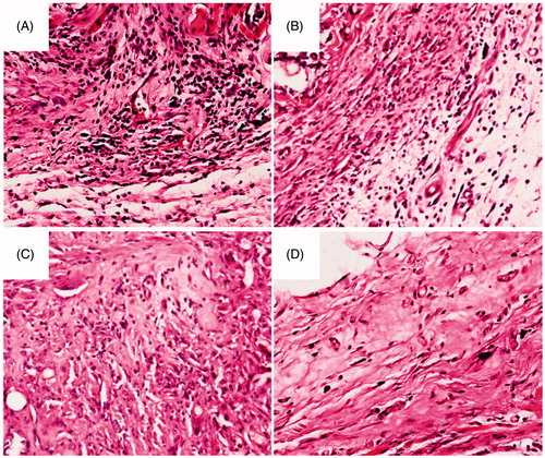 Figure 8. Histological analysis of tissue response to the DTX/PDLLA nanofibers after (A) 2 weeks, (B) 4 weeks, (C) 6 weeks and (D) 8 weeks. There was a dense accumulation of inflammatory cells presented around the DTX/PDLLA fibrous scaffolds at week 2, which degraded over time and disappeared at week 8.