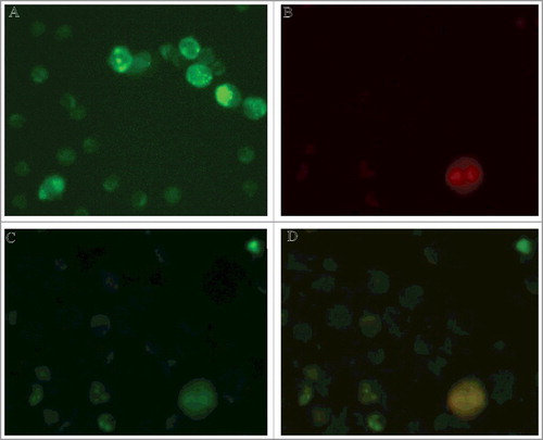 Figure 1. Relocation of S100A4 protein from lymphocytes to the surface of cancer target cell. A,B. Double immunostaining for S100A4 and CD95 revealed exclusive expression of S100A4 protein in lymphocytes (green), while CD95 expression was limited to K562 cell before cell contact (red). С. Immunostaining with anti-S100A4 antibodies detected lymphocytes as well as cancer cell. (10.0x/1.40 NA oil objective). D. Co-localization of S100A4 and CD95 on the surface of K562 target cell after contact with lymphocytes.