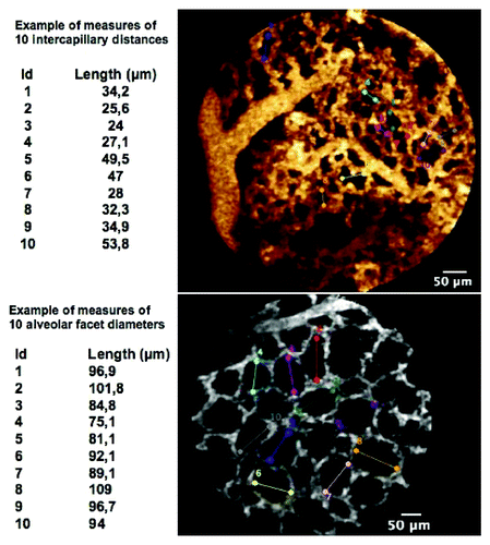 Figure 7. Examples of measurements of (top) intercapillary distances, and (bottom) alveolar facets diameters.