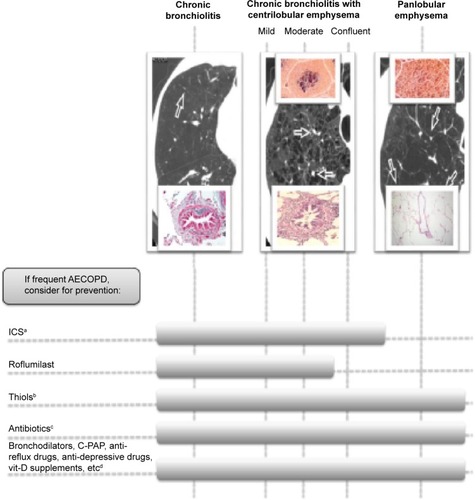 Figure 2 The different preventive approach to acute exacerbation in COPD.