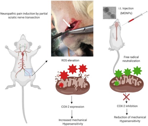 Figure 5 Experimental scheme for this study. Neuropathic pain was induced by partial sciatic nerve ligation in Wistar rats. MONPs were then administered intrathecally 14 days post nerve transection. Pain tested by using Dynamic Plantar Aesthesiometer was significantly attenuated in rats injected with MONPs compared with the saline-injected group. Scheme created with BioRender imaging software.