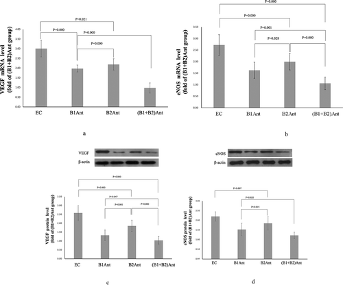 Figure 1. VEGF and eNOS mRNA and protein levels in cardiac muscle. (a) VEGF mRNA level, (b) eNOS mRNA level, (c) VEGF protein level, (d) eNOS protein level. VEGF was detected as an immunoreactive band at approx. 23 kDa, eNOS was detected as an immunoreactive band at approx. 140 kDa