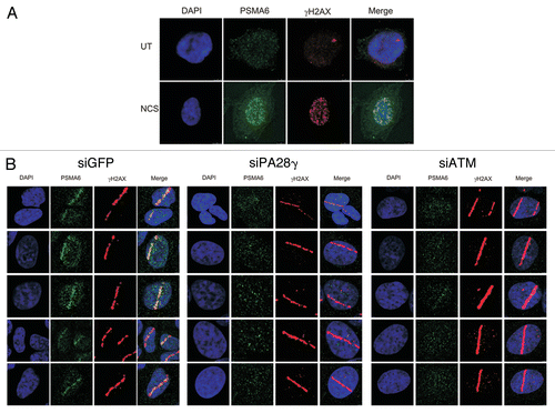 Figure 7 PA28γ- and ATM-dependent recruitment of the 20S proteasome to DNA damage sites. (A) CAL51 cells were treated with 200 ng/ml NCS for 30 min and co-stained with antibodies against the 20S core proteasome subunit PSMA6 and γH2AX. (B) U2OS cells were transfected with siRNAs against GFP or PA28γ or ATM, and localized DNA damage was induced 72 h later by a laser microbeam. Twenty min later, the cells were co-stained with antibodies against PSMA6 and γH2AX.