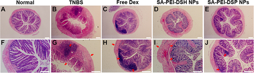 Figure 8 Histological sections of the colon stained with hematoxylin and eosin (HE). (A–E). Complete colon sections in different treatment groups, scale bars: 200 μm. (F–J). Local magnified view of colon sections in different treatment groups, corresponding to figure (A–E), respectively, scale bars: 100 μm. The area indicated by the arrow: TNBS group: the colon crypt structures are collapsed with significant inflammatory cell infiltration, and the intestinal wall is significantly thickened; Free Dex group: significant inflammatory cell infiltration appeared in colon tissues with the thickened intestinal wall; SA-PEI-DSH NPs group: the intestinal wall is thickened and partial colon tissues showed inflammatory cell infiltration; SA-PEI-DSP NPs group: local colon tissues showed inflammatory cell infiltration.