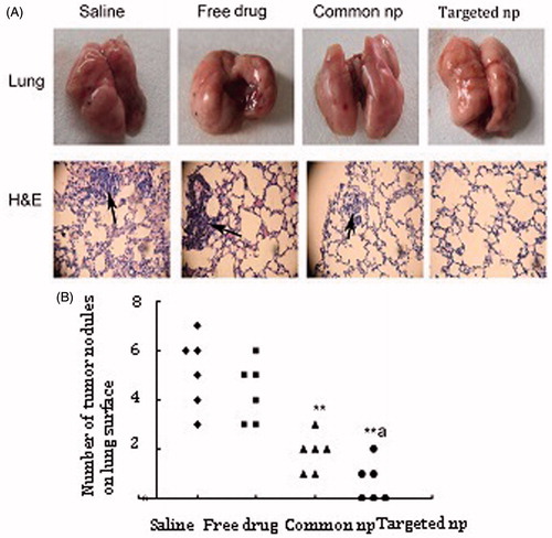 Figure 2. Pemetrexed-loaded PEG–Peptide–PCL nanoparticles inhibited pulmonary metastasis. (A) Macroscopic pictures of cancer cell affected lungs from five treatment groups (top panel) (n = 6). Tumor cells were visualized by H&E staining on paraffin-embedded tissue sections (bottom panel, black arrows indicated tumor cells; amplification: 40×). Common np: pemetrexed-loaded PEG–PCL nanoparticles; targeted np: pemetrexed-loaded PEG–Peptide–PCL nanoparticles. (B) Lung metastasis burden was calculated by counting the number of tumor nodules on the lung surface (n = 6). **p < 0.01 versus the saline group, ap < 0.05 versus the common nanoparticles group.