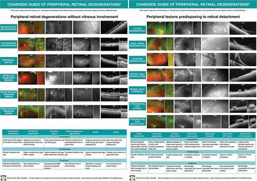 Figure 18. Chairside guide of peripheral retinal degenerations including summary of presentation, epidemiology (if known), prognosis and appearance with ocular imaging.