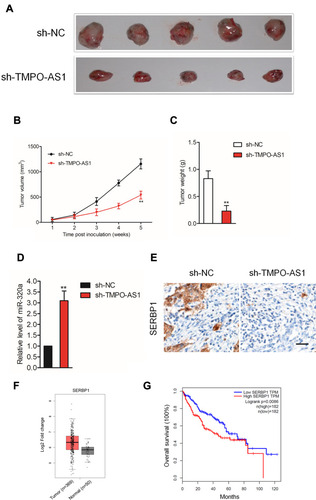 Figure 7 Downregulation of TMPO-AS1 inhibits SNU-387 cell growth in vivo. (A) The appearances of the tumors harvested from euthanized SNU-387 tumor-bearing nude mice. (B, C) The tumor volume and weight of nude mice subcutaneously injected with SNU-387 cell. (D) qRT-PCR analysis of miR-320a level in tumor tissue formed by sh-NC or sh-TMPO-AS1 transfected SNU-387 cell. **P<0.01 compared with sh-NC. (E) IHC staining for SERBP1 in tumor tissue formed by sh-NC or sh-TMPO-AS1 transfected SNU-387 cell. (F) The expression of SERBP1 in HCC tissues (n=369) and normal tissues (n =50) from GEPIA analysis. Red box, HCC tissues (T); black box, normal tissue (N). (G) The correlation between expression of SERBP1 and overall survival of HCC patients from GEPIA analysis. Red, patients with high level of SERBP1; blue, patients with low level of SERBP1.