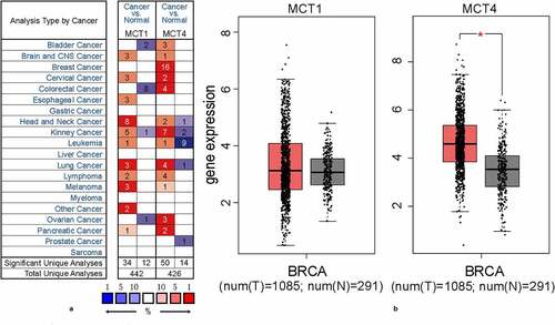 Figure 1. The expression profiles of MCT1 and MCT4 in tumor and normal tissues