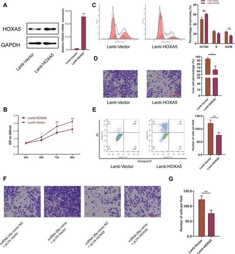 Figure 4 Overexpression of HOXA5 inhibits cell proliferation, cell cycle, and migration, but promote apoptosis. (A) Both mRNA and protein levels were elevated by lentivirus mediated transfection of HOXA5 gene in U2OS cells. (B) MTT assay shows that overexpression of HOXA5 inhibits cell proliferation. (C) FCM assay and quantitative assay showed that overexpression of HOXA5 increased cell numbers of G1 phase. (D) Transwell assay and quantitative assay showed that overexpression of HOXA5 inhibited cell migration. (E) FCM assay and quantitative assay showed that overexpression of HOXA5 promotes cell apoptosis. (F) Overexpression of HOXA5 could rescue the effects induced by miR-26a mimic in migration of osteosarcoma cells and (G) quantitative analysis. Data are presented as mean±S.D. of three independent experiments. *P<0.05, **P<0.01. Scale bar 200μm.