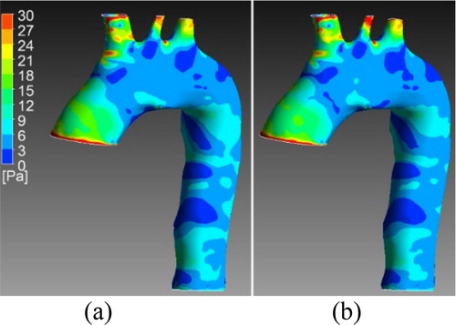 Figure 1. WSS at systole for one validation case. a) Results from the simulation b) Results from the ROM.