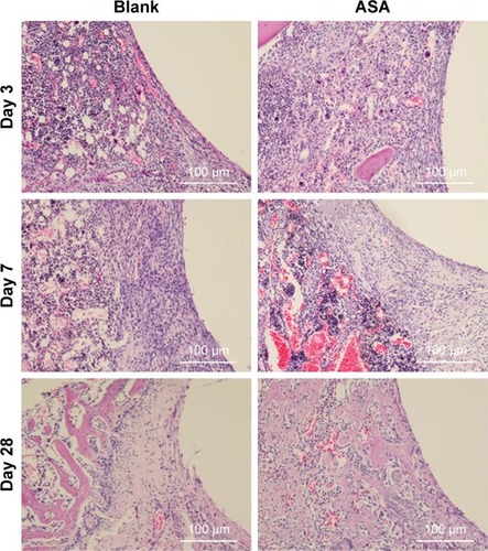 Figure 6 Histological analysis of bone formation in vivo.Notes: Three days after implantation: the small, deeply stained cells adjacent to the surface of the implants were inflammatory cells infiltrating the tissues. In addition, multinucleated giant cells were scattered in the tissues. There was little difference between the two groups. Seven days after implantation: the inflammatory cells infiltrating the implant surface were significantly more numerous in the blank group than in the ASA group, and bone matrix began to appear in the ASA group. Twenty-eight days after implantation: short, cubic preosteoblasts arranged around the trabecular bone were well formed around the ASA-loaded implants; at the same time, newly formed, small blood vessels were scattered in the trabecular bone at the ASA-loaded surface.Abbreviation: ASA, aspirin.