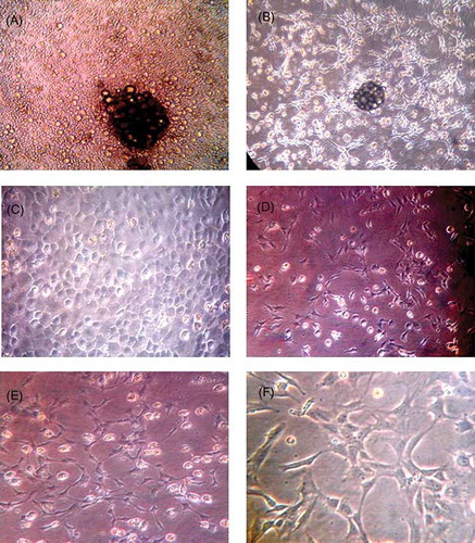 Figure 1. Morphology character of EPCs at different times (A–E) ×200, (F) ×400. (A) On the fourth day, small colonies were visible, with some larger cells in the central, surrounded with a few single cells. (B) On the seventh day, there were a large number of short spindle cells around the colonies, and some were end-to-end adherent. (C) On the 10th day, cells covered bottom, and were round or short spindle, “cobblestone” appearance. (D) Secondary cultured cells were smaller and showed short spindle or polygonal cells. (E, F) Cells connected to each other, showing cord-like or vessel-like growth trends.