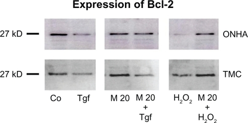 Figure 8 Effect of minocycline treatment on Bcl-2 protein expression. ONHA and TMC were treated with minocycline 20 μM only or additionally with TGFβ-2 (1 ng/mL) or 600 μM H2O2. Western blotting was used to analyze protein expression in control (Co) and treated cell extracts: TGFβ-2 (Tgf), 20 μM minocycline (M20), minocycline 20 μM and TGFβ-2 (M20+Tgf), 600 μM H2O2 (H2O2), and minocycline 20μM and 600 μM H2O2 (M20 + H2O2). Ten micrograms of protein was loaded per lane.