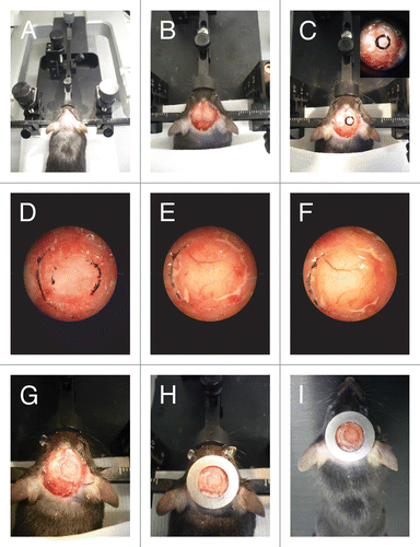 Figure 3. CIW surgery. (A) The mouse head is shaved and fixed on a stereotaxic frame. (B) The skin is cut in a circular manner around the skull and the periosteum is scraped. (C) 5mm diameter circle is drawn around the region of interest. (D) A groove is drilled around the region of interest. (E) Cold cortex buffer is applied during drilling. (F) The craniotomy is lifted under a drop of saline exposing the brain. (G) The brain is covered with silicone oil and sealed with a 6 mm diameter coverslip. (H) Dental cement is applied to cover exposed skull and a stainless steel ring is glued parallel to the coverslip. (I) The mouse is injected with 100 μg/kg of buprenorphine and allowed to recover on a heating pad.